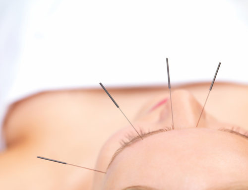 Acupuncture: How It Works And What It Does