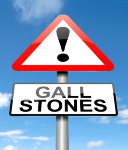 non-surgical treatments for Gallstones